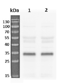 RPS6A | 40S ribosomal protein S6-1 in the group Antibodies Plant/Algal / DNA/RNA/Cell Cycle / Translation at Agrisera AB (Antibodies for research) (AS19 4292)